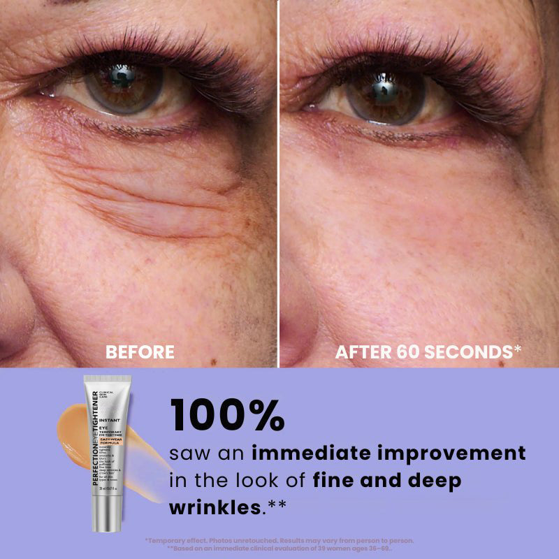 Tired of Puffy Eyes, Fine Lines & Crow’s Feet? Get Instantly Lifted, Smooth Under-Eyes in 60 Seconds – No Caking, No Tightness!